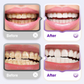🦷 OFERTA OGRANICZONA CZASOWO! 🎁 Prezent: szczoteczka do zębów z 3 główkami! 💖 Niacynamid | Lśniące i zdrowe zęby w 7 dni!